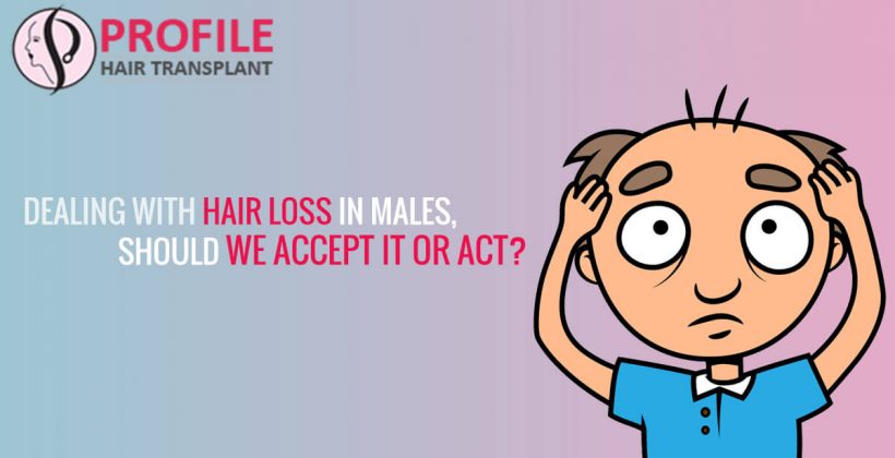 Dealing With Hair Loss In Males, Should We Accept It Or Act?