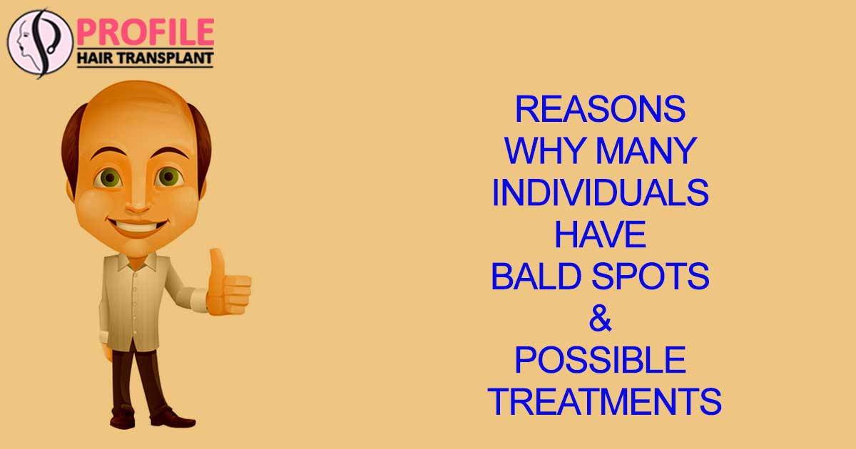 Reasons why many Individuals have bald spots & Possible treatments