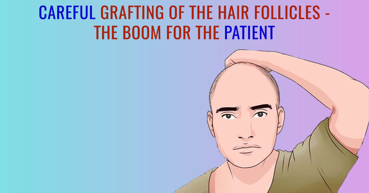 Careful Grafting of the Hair Follicles The boom for the patient