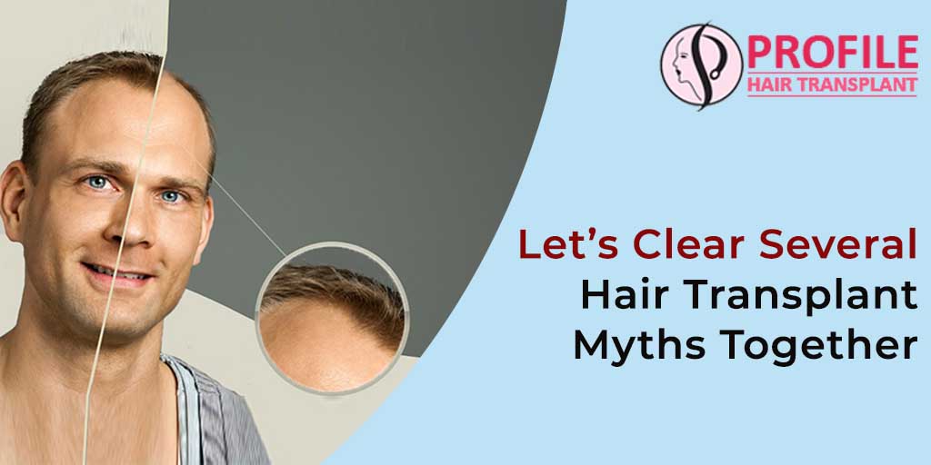 Let’s Clear Several Hair Transplant Myths Together
