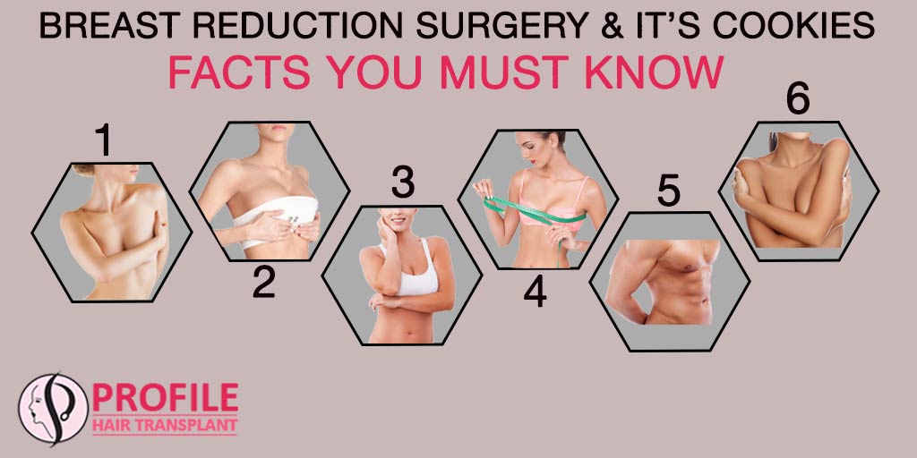 Breast Reduction Surgery & It’s Cookies: Facts You Must Know!