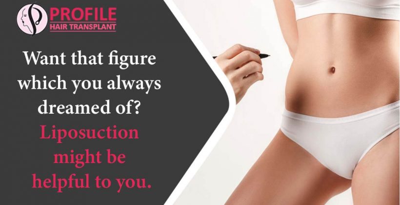 Want That Figure Which You Always Dreamed Of? Liposuction Might Be Helpful To You