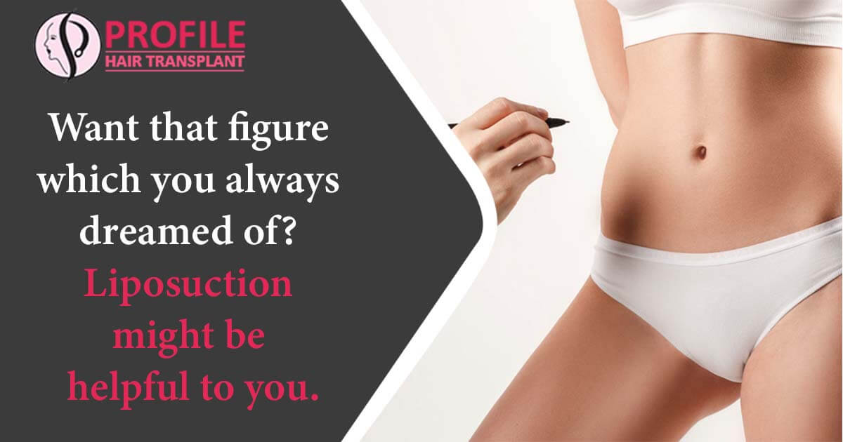 Want That Figure Which You Always Dreamed Of? Liposuction Might Be Helpful To You