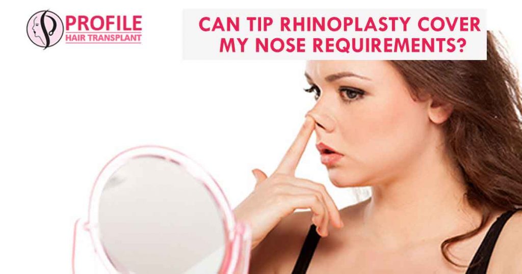 Can Tip Rhinoplasty Cover My Nose Requirements?