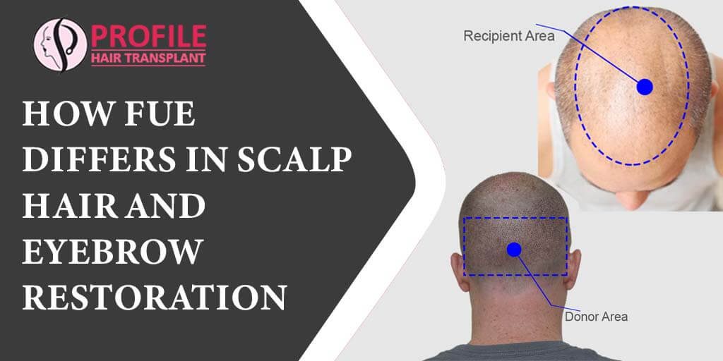 HOW FUE DIFFERS IN SCALP HAIR AND EYEBROW RESTORATION