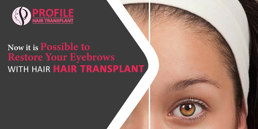 Now it is Possible to Restore your Eyebrows with Hair Transplant