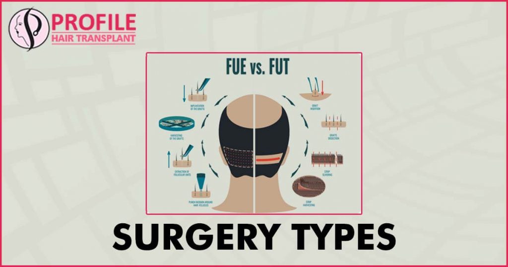 Surgery Types