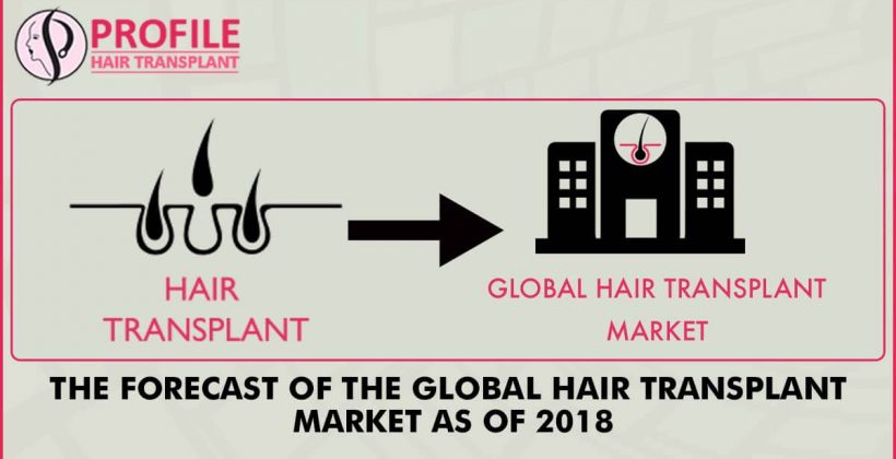 The Forecast of The Global Hair Transplant Market As Of 2018
