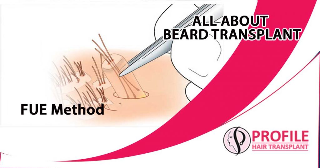 All about beard transplant