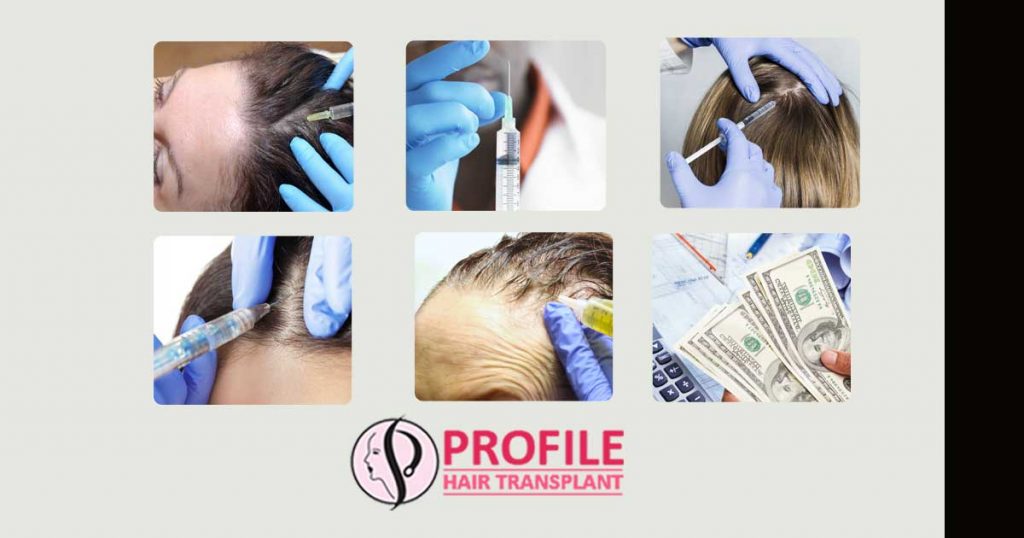 Hair specialists also recommend this procedure for the patients due to the following reasons