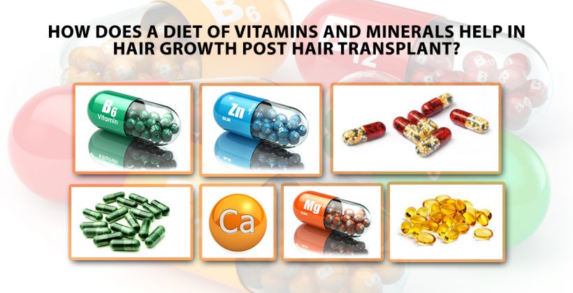 How Does A Diet Of Vitamins And Minerals Help In Hair Growth Post Hair Transplant?