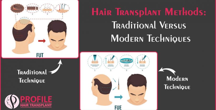 Hair Transplant Methods: Traditional Versus Modern Techniques