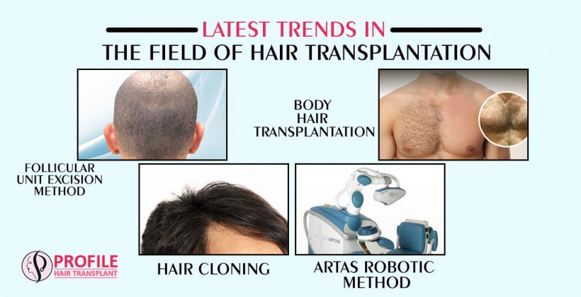 Hair Transplant Cost in Khanna | FUE Hair Transplant in Khanna