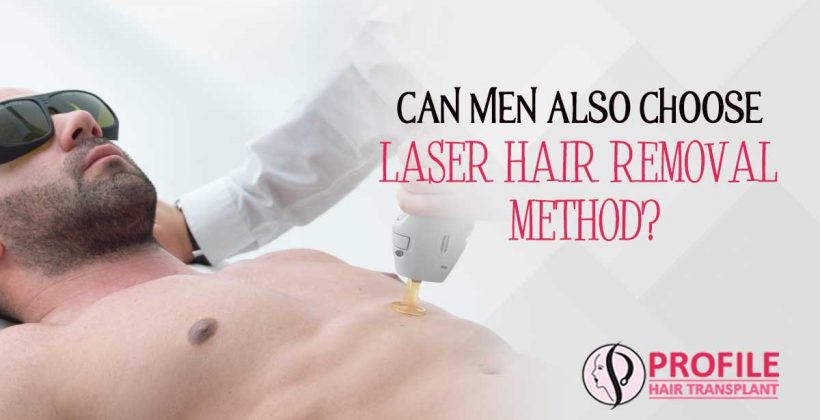 Can Men Also Choose Laser Hair Removal Method?