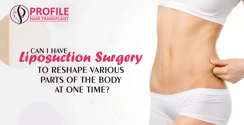 Liposuction Surgery Cost in Patiala – Liposuction Surgery Centre in Patiala