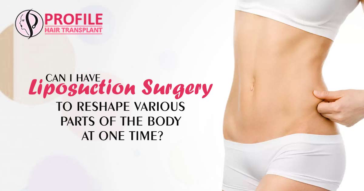 Liposuction Surgery Cost in Patiala – Liposuction Surgery Centre in Patiala