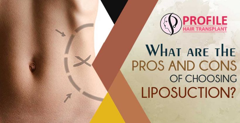 Liposuction Surgery Cost in Chandigarh – Liposuction Surgery Centre in Chandigarh