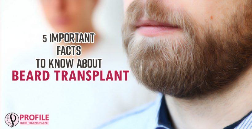5 Important Facts To Know About Beard Transplant