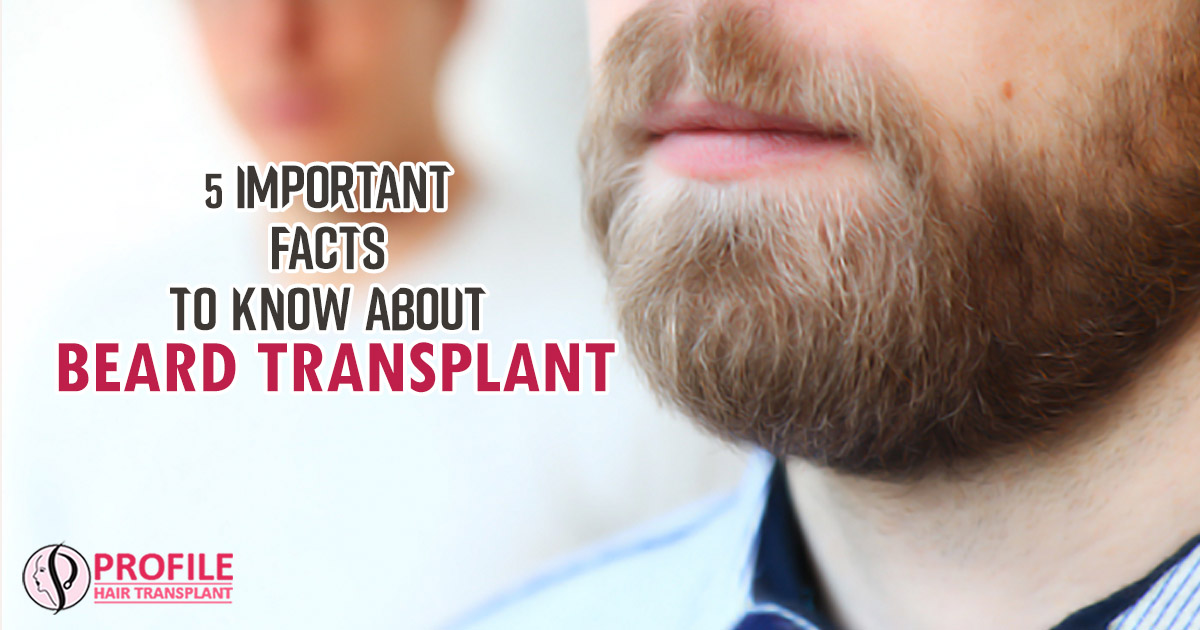 5 Important Facts To Know About Beard Transplant