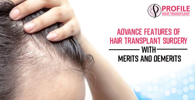 Advance Features of Hair Transplant Surgery with Merits and Demerits