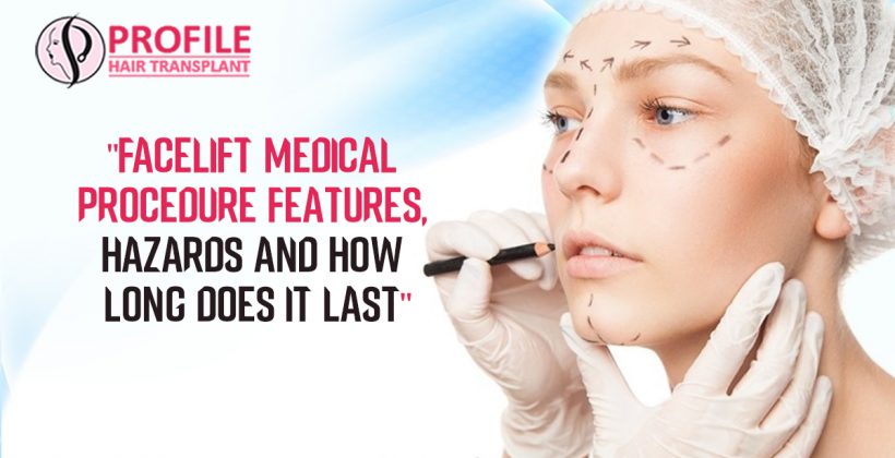 Facelift Medical Procedure Features, Hazards and how long does it last