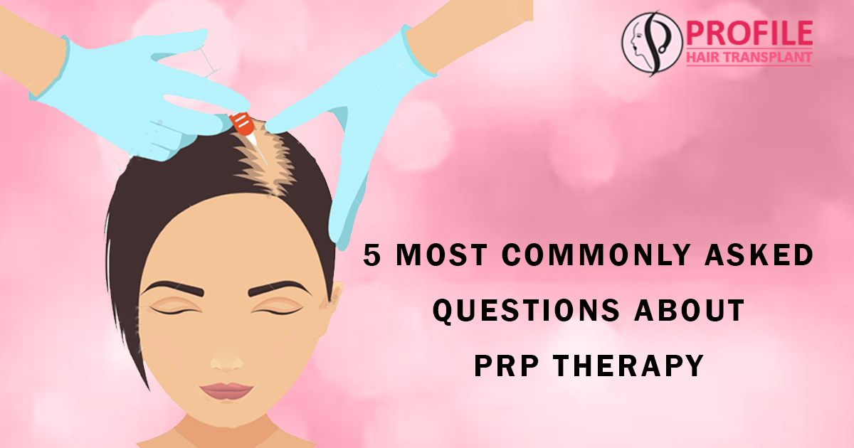5 Most Commonly Asked Questions about PRP Therapy