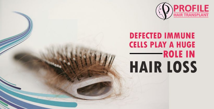 Defected Immune Cells Play A Huge Role In Hair Loss
