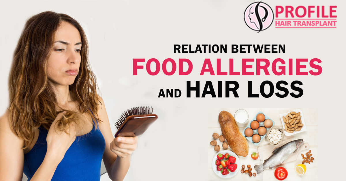Relation Between Food Allergies And Hair loss