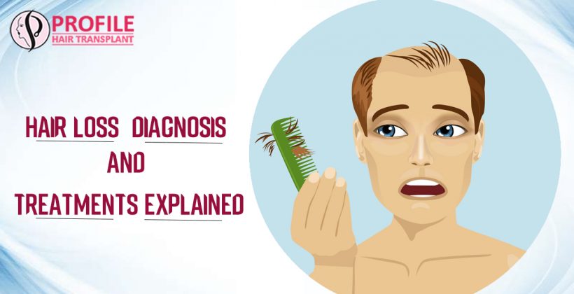Hair Loss – Diagnosis And Treatments Explained