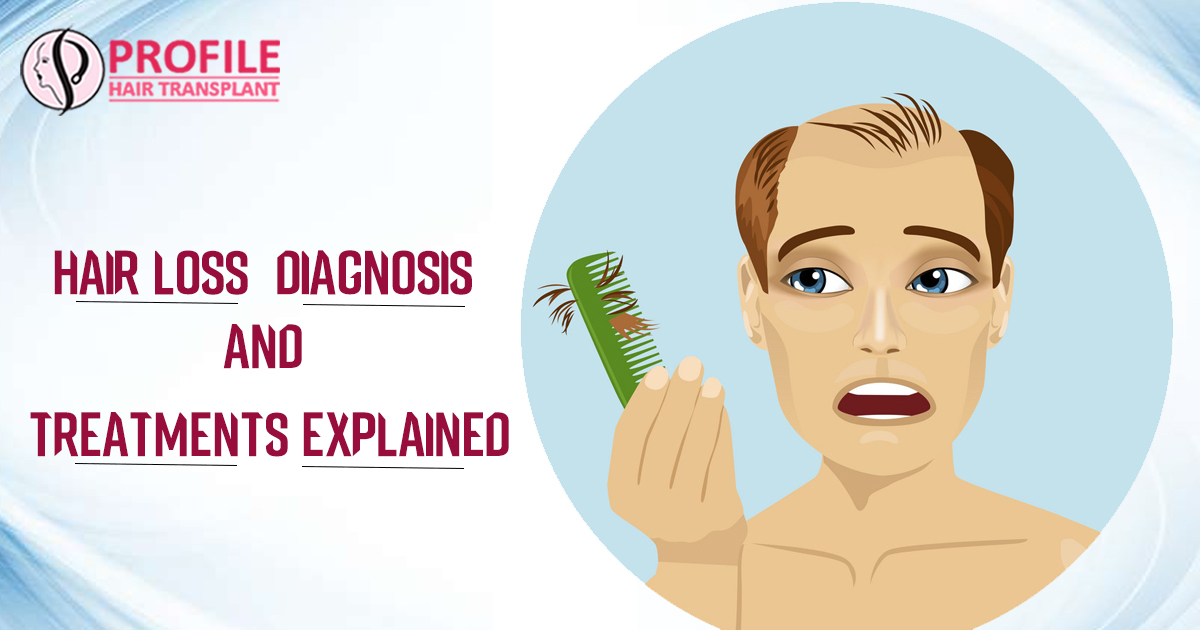 Hair Loss – Diagnosis And Treatments Explained