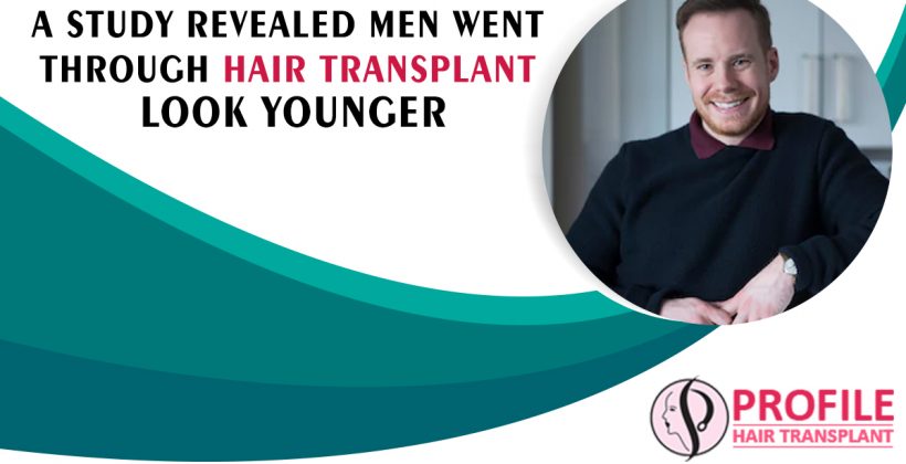 A Study Revealed Men Went through Hair Transplant Look Younger