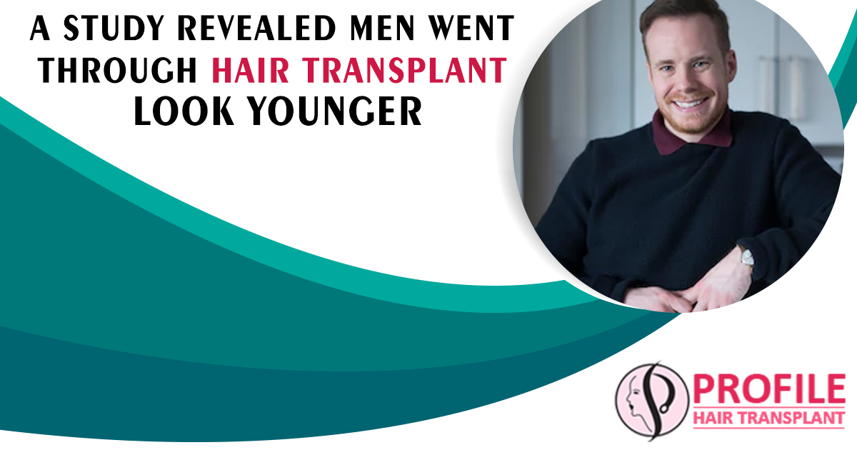 A Study Revealed Men Went through Hair Transplant Look Younger