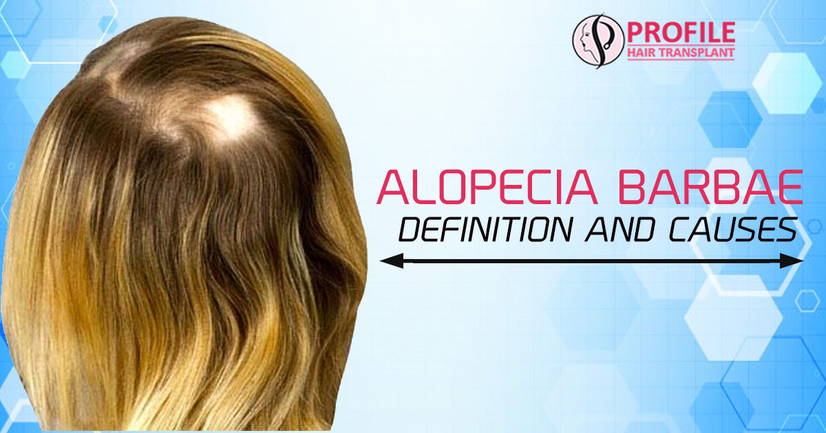 Alopecia Barbae – Definition and Causes