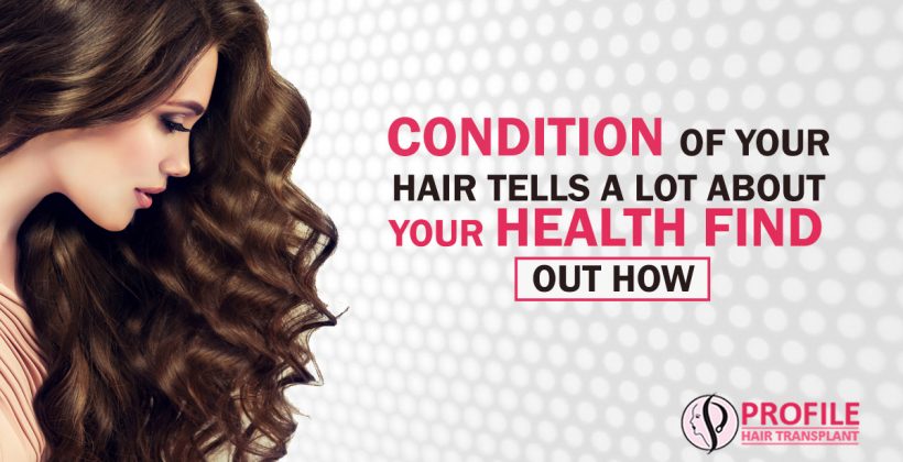 Condition of Your hair Tells A Lot About your Health, Find Out how