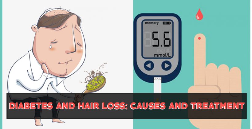 Diabetes & Its Relation With Hair Loss