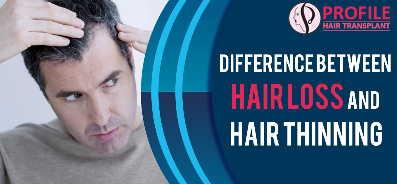 Difference Between Hair Loss And Hair Thinning