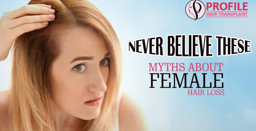 Never Believe These Myths About Female Hair Loss