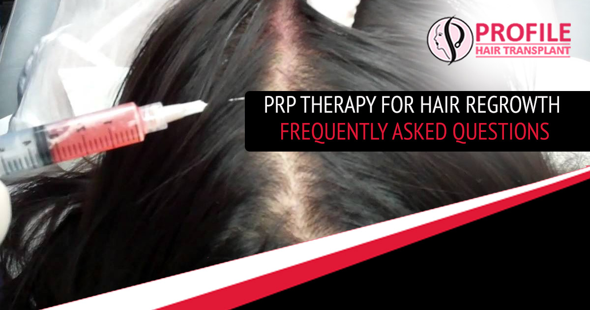 PRP Therapy for Hair Regrowth – Frequently Asked Questions