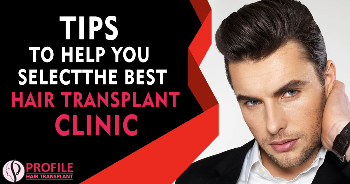 Tips to Help you select The best Hair Transplant Clinic