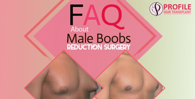 Faq About Male Boobs Reduction Surgery