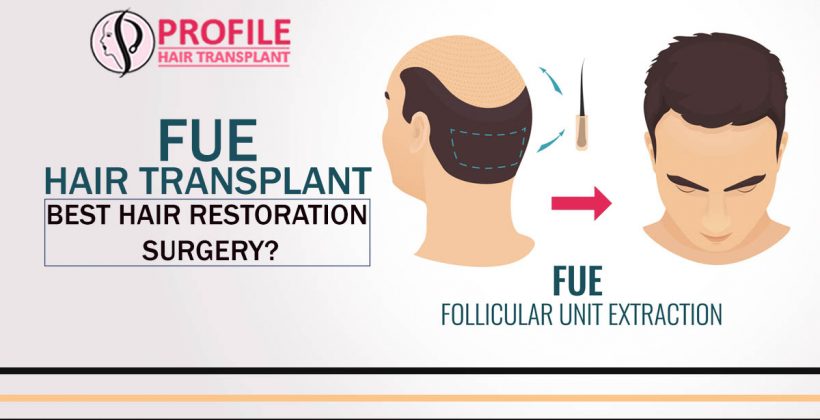 FUE hair Transplant – Best hair Restoration surgery?