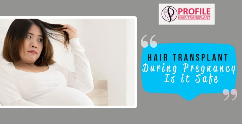 Hair Transplant During Pregnancy – Is It Safe?