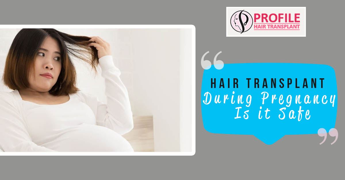 Hair Transplant During Pregnancy – Is It Safe?