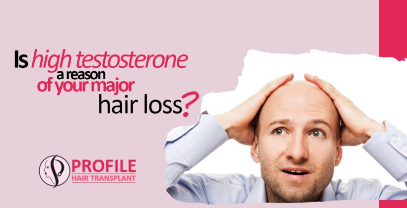 Is High Testosterone A Reason Of Your Major Hair Loss?