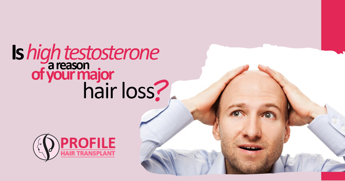 Is High Testosterone A Reason Of Your Major Hair Loss?