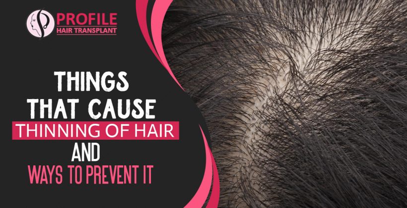 Things That Cause Thinning Of Hair And Ways To Prevent It