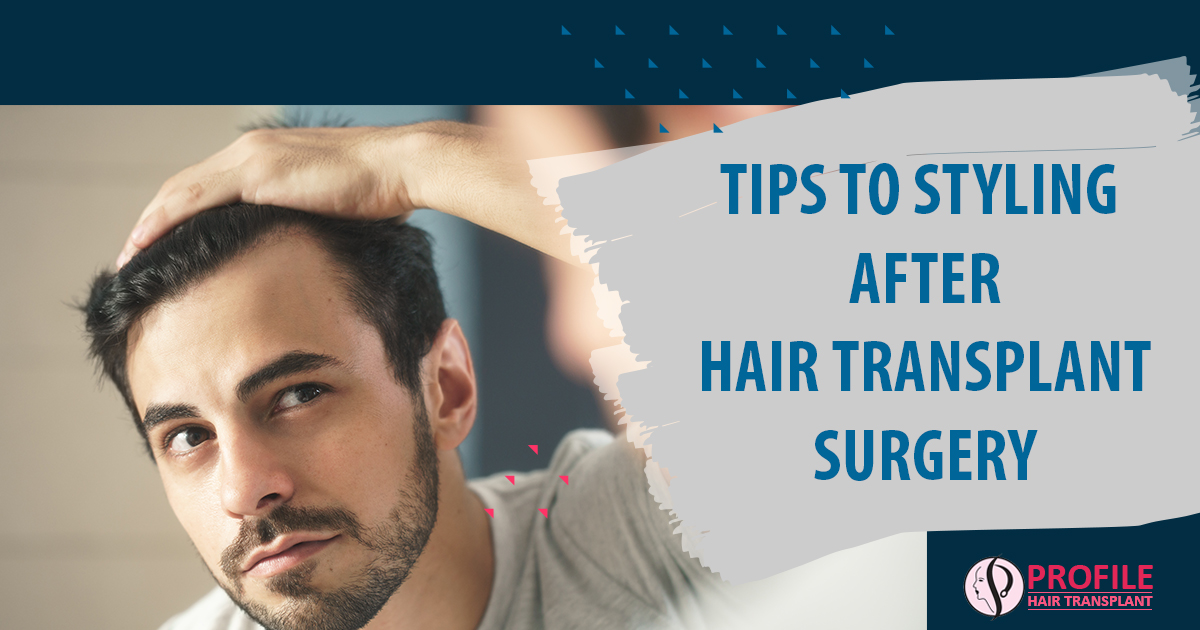 Tips To Styling After Hair Transplant Surgery