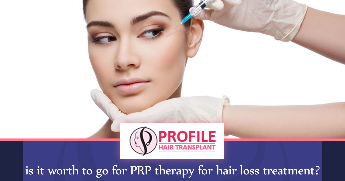 Is It Worth To Go For PRP Therapy For Hair Loss Treatment?
