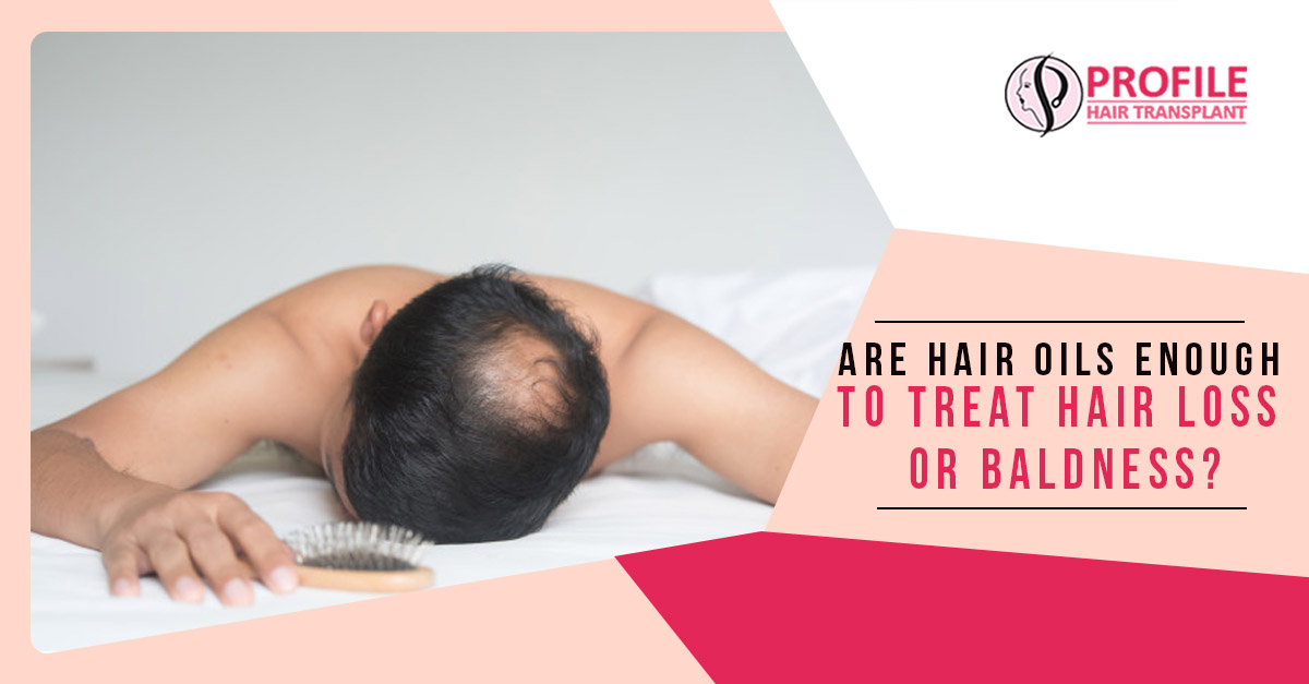Are Hair Oils Enough To Treat Hair Loss Or Baldness?