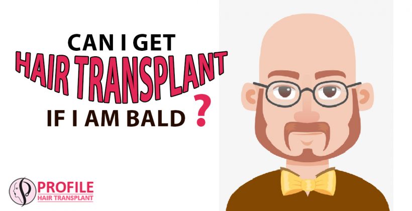 Can I Get Hair Transplant if I Am Bald?